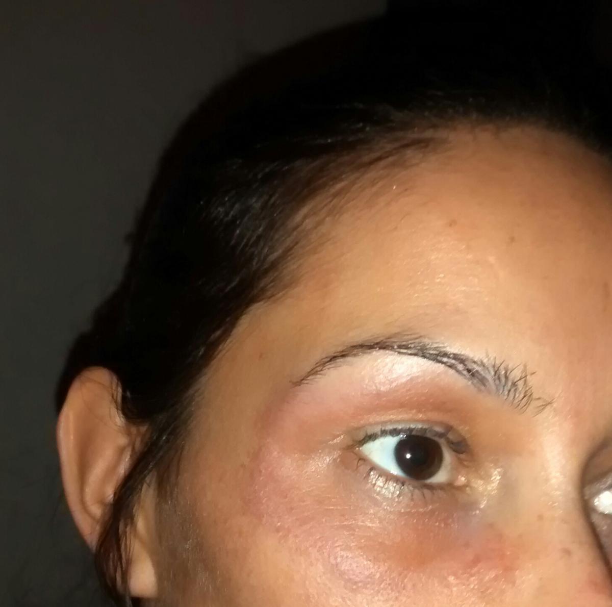 La máscara para osvetleniya de las ojeras