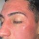 Integramedica - Dermatología adulto